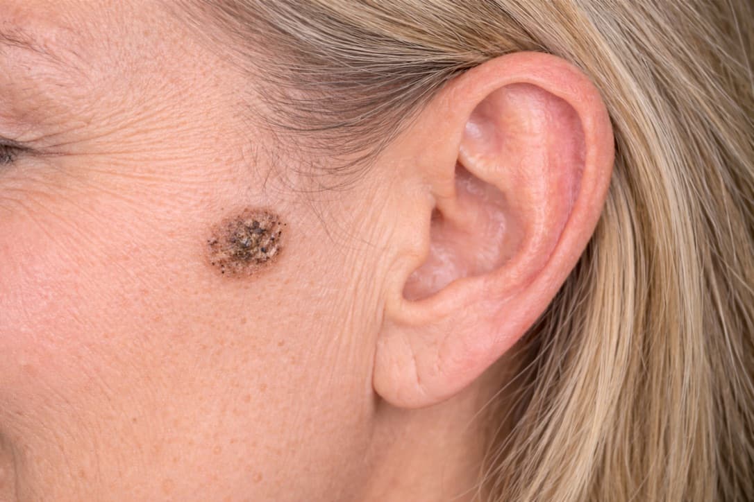 Cutivelle™ - (Arbetsnamn)